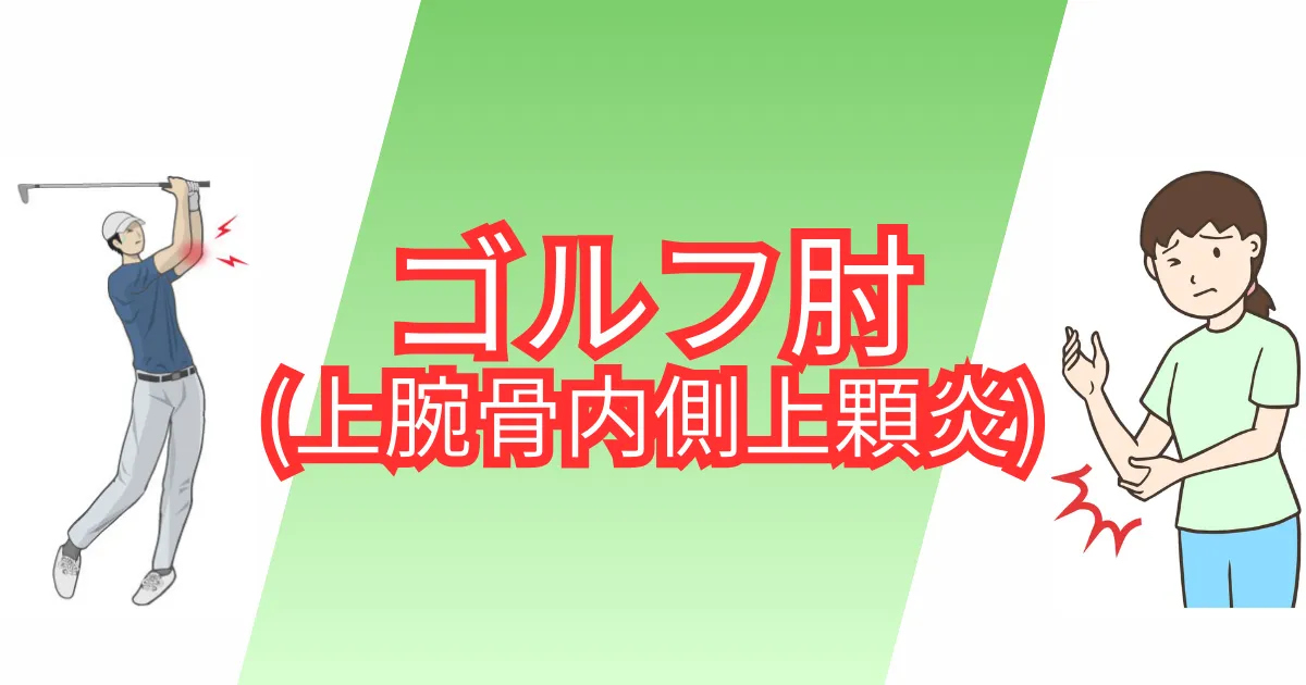 ゴルフ肘(上腕骨内側上顆炎)のサムネイル